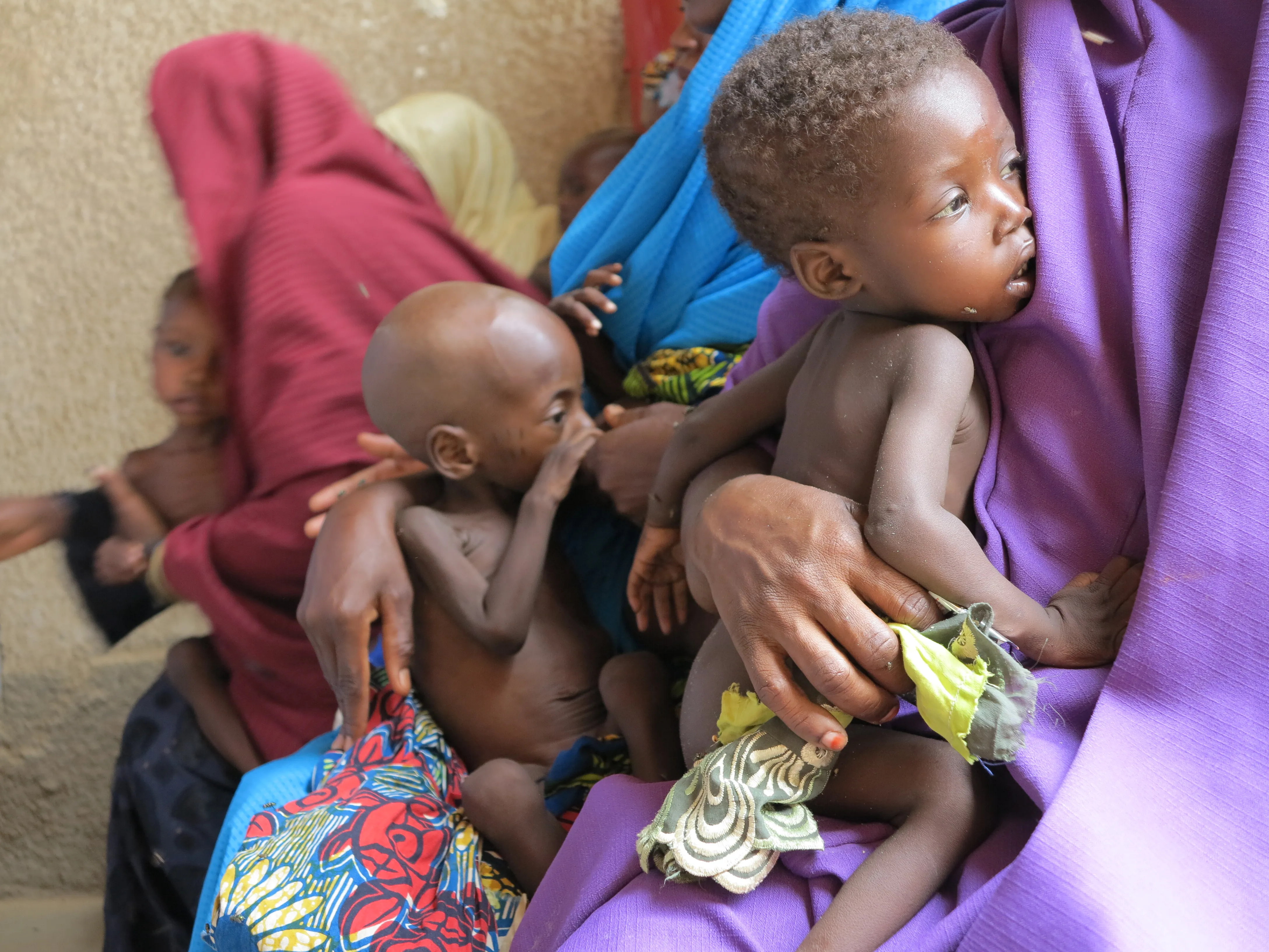 Part III: How Government Funding Can Turn Around Prevalence of Malnourished Children in Nigeria Image